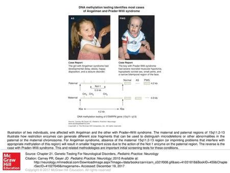 16 prader-willi angelman and 15q11-q13 duplication syndromes|maternal dup15q syndrome.